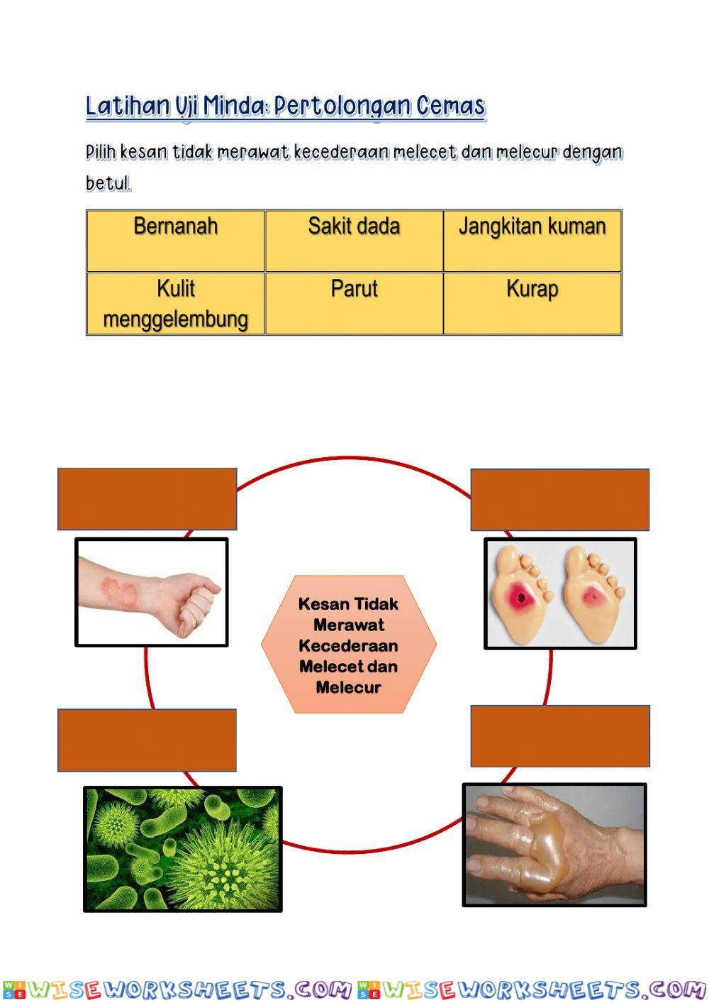 Kesan Tidak Merawat Kecederaan Melecet dan Melecur